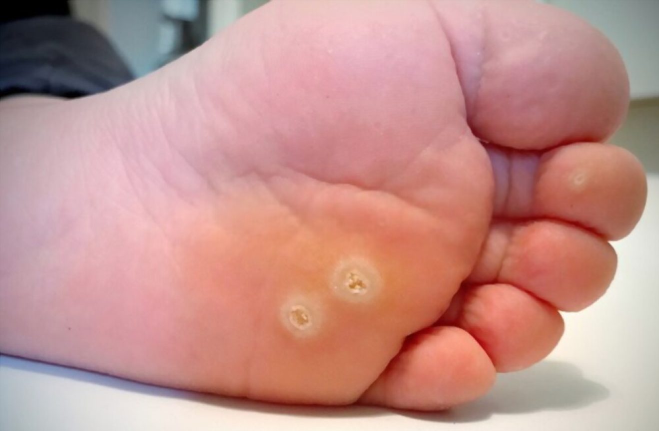 Reasons And Risks Of Walking Barefoot On Treadmill - The Shoe Box NYC